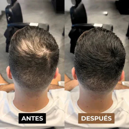 CAPILUX - Solución capilar instantánea ,100% EFECTIVO (FACEBOOK)