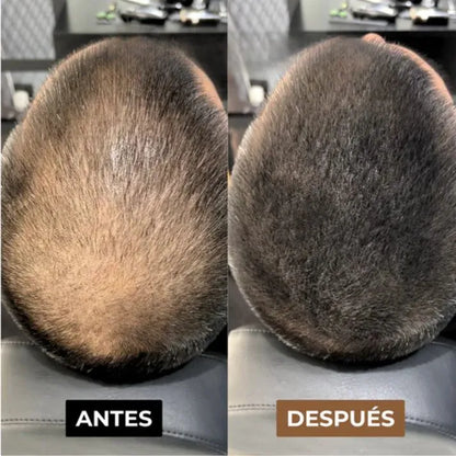 CAPILUX - Solución capilar instantánea ,100% EFECTIVO (FACEBOOK)