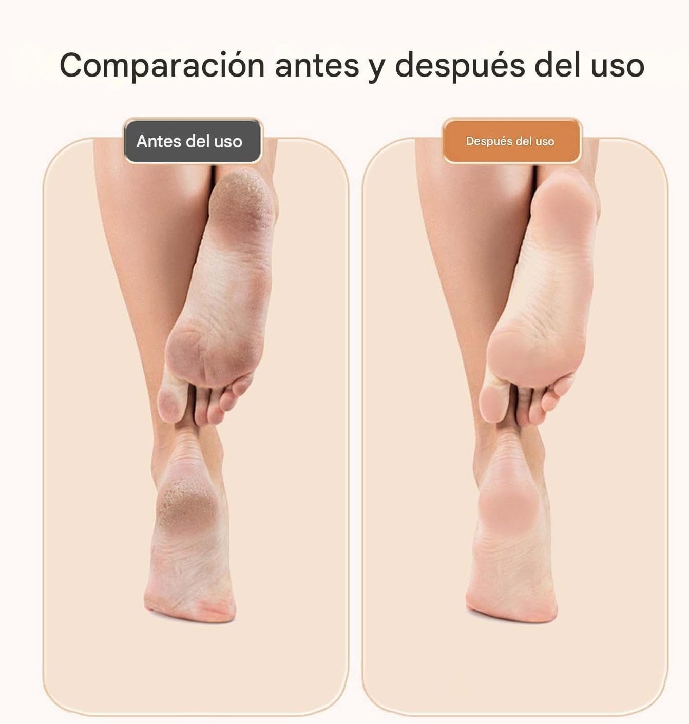 Removedor de callos(Pies)