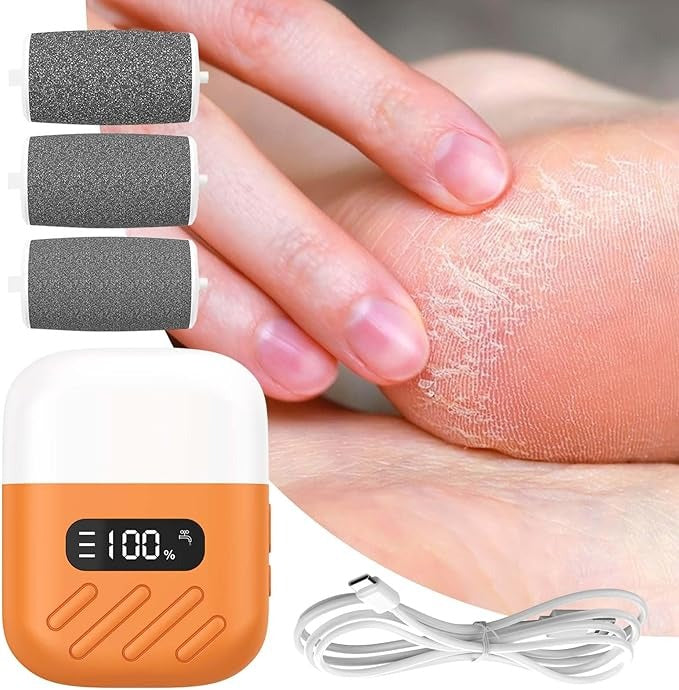 Removedor de callos(Pies)